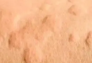 ����˯��Ƥ������ô�� Ƥ��ֹ�������������