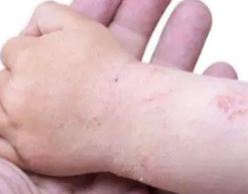 ����˯��Ƥ������ô�� Ƥ��ֹ�������������