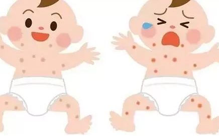 �������ϸ���ʪ���ԭ�� �������ϸ�ʪ����������