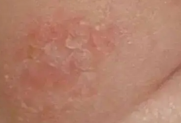�������ϸ���ʪ���ԭ�� �������ϸ�ʪ����������