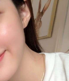 ����֪ʶ֮�沿Ƥ��ѧ �沿��������