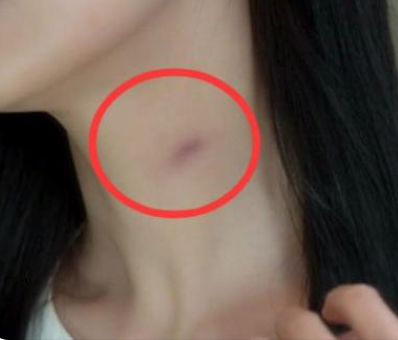 ��ݮӡ��ô�ǳ����� ����ݮӡ�ļ��ɺ���ȷ��ʽ