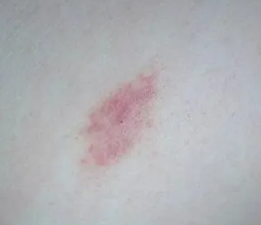 ��ݮӡ��ô�ǳ����� ����ݮӡ�ļ��ɺ���ȷ��ʽ