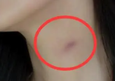 �ֲ�ݮ�ļ��ɸ���ô�� �ڶԷ��Ĳ��������²�ݮӡ