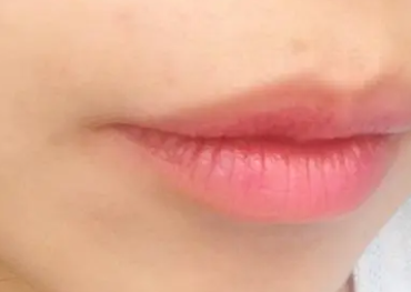 �����ü򵥵ķ���ȥ����ë ���Ǽ��μ�ˮͨ���ǲ�����ȥ��ë��