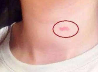 ��ݮӡ��ô�ǳ����� ����ݮ�Ǻ�һ��ע������ѡ���λ��