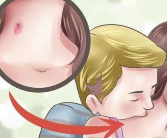 ����ֲ�ݮ�Ǻ� ��ݮ��ô���Ǻ�