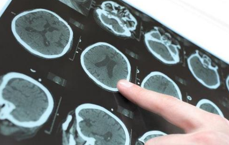 Ƶ����CT�����°��� ͨ���ǲ����°���