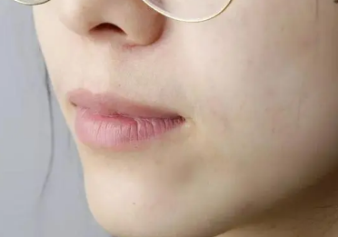 ������ο���ȥ��ë�� ��ë��ôȥ��