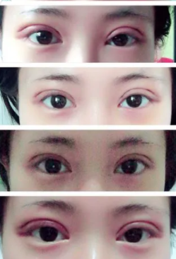 �������Լ����۾� ��˫��Ƥ��1-7��ָ�ͼ