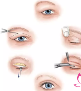 �������Լ����۾� ��˫��Ƥ��1-7��ָ�ͼ