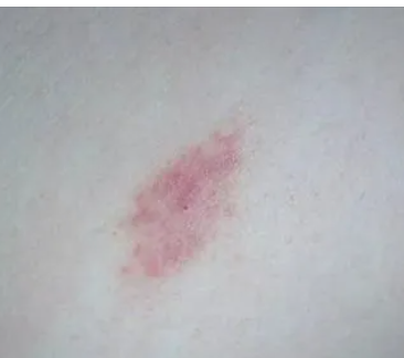 ��ݮӡ��ô�� ������ô����ݮӡ���岽��