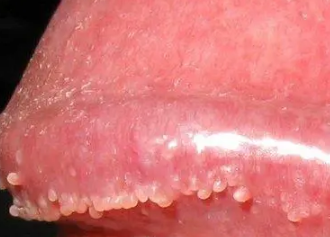 �������С��������ͼƬ �񵭺�ɫС����