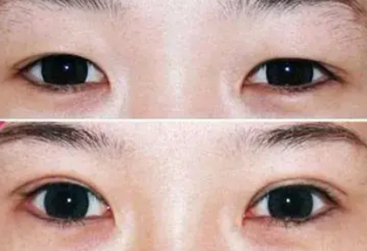 ��˫�͵���Ƥ������ ��˫Ҳ����һ��˫��Ƥ