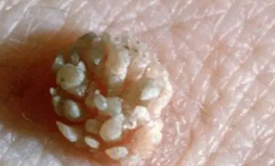 �������С��������ͼƬ �񵭺�ɫС����