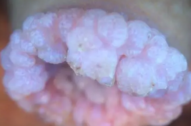 �������С��������ͼƬ �񵭺�ɫС����