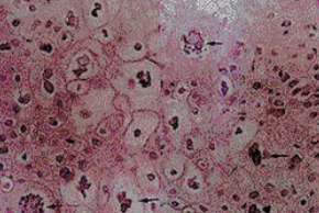 �������С��������ͼƬ �񵭺�ɫС����