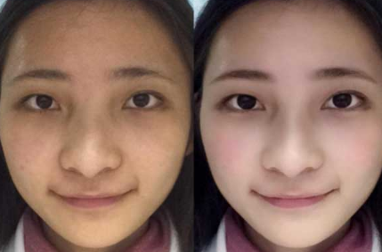 跑步可以改变脸型吗 对比情况会是如何的