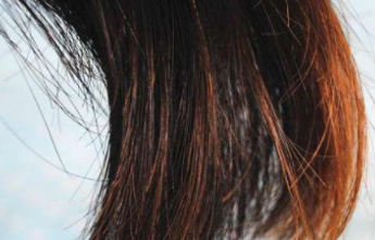 气血不足症状明显是什么样子的 气血不足的十大症状