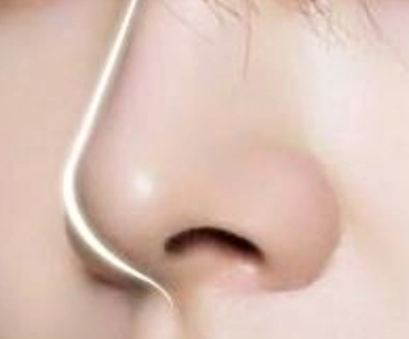 隆鼻恢复过程图片一周 7天内的恢复还是很不明显