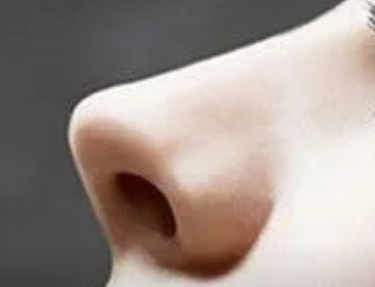 隆鼻恢复过程图片一周 7天内的恢复还是很不明显