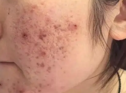 ���ϳ�����������Ϳˬ��ˮ�� ��������Ҫע��ļ���