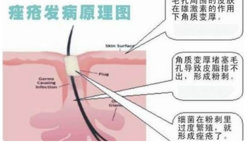 ���ϳ�����������Ϳˬ��ˮ�� ��������Ҫע��ļ���