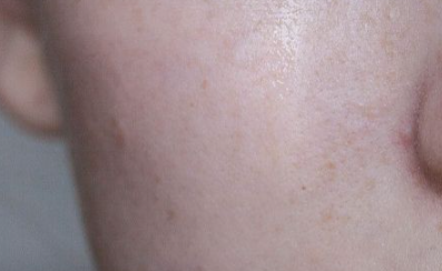 ����ë��ҽ���ļ۸� ҽ���ļ۸�1000��3000Ԫ