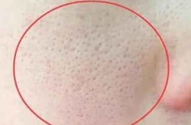 ����ë��ҽ���ļ۸� ҽ���ļ۸�1000��3000Ԫ