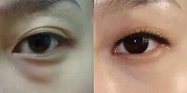 ȥ�۴��Ƕ������û���΢���� ΢�����۴�����������