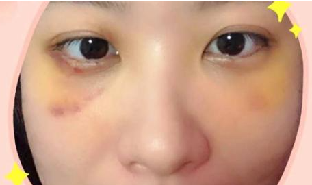 ȥ�۴��Ƕ������û���΢���� ΢�����۴�����������