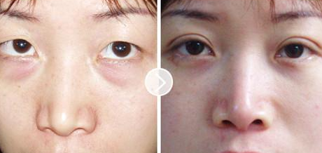 ȥ�۴��Ƕ������û���΢���� ΢�����۴�����������