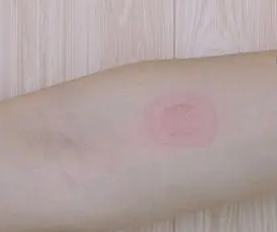 在大腿内侧种草莓什么感觉 身体哪些部位容易留下吻痕