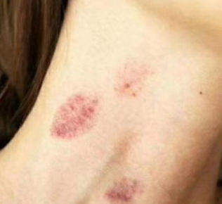 ��ݮӡ��ô�������� ����ݮ�Ĳ��輼��