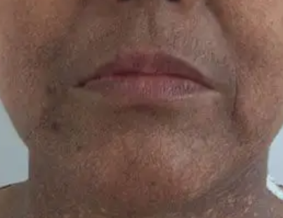 脸色暗沉发黑什么原因 脸色蜡黄的原因