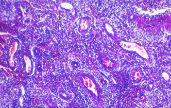 甲亢症状有哪些症状 如何预防孩子得甲亢