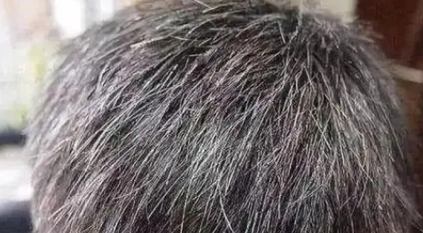 ���ư�ͷ��10��ƫ�� ���ݺڶ����ư�ͷ���������