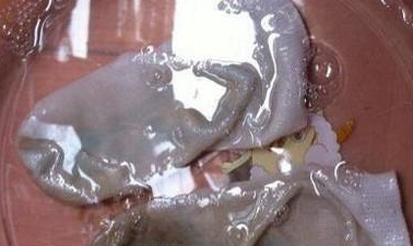 �����ȷϴ���� �����˷����ܼ�