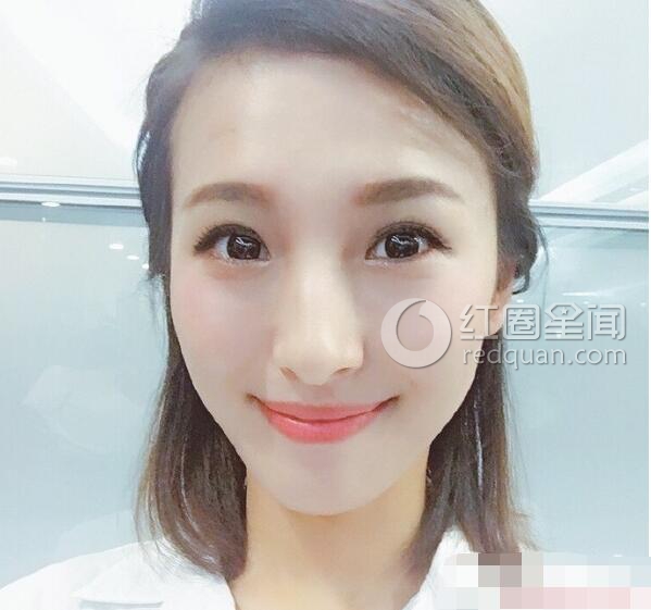 张星月结婚了吗 张星月绯闻多不多