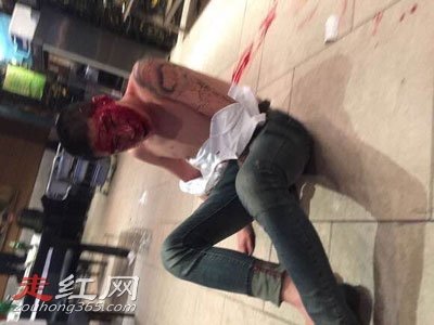 刘一手被打一脸血视频怎么回事 在北京被人打纯属偶然