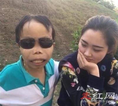 ��ɽȥ�������� ���к�ƶѪ֢��û����ô����