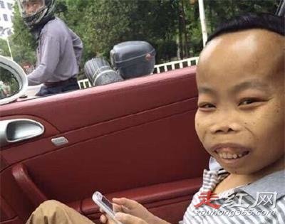 ��ɽȥ�������� ���к�ƶѪ֢��û����ô����