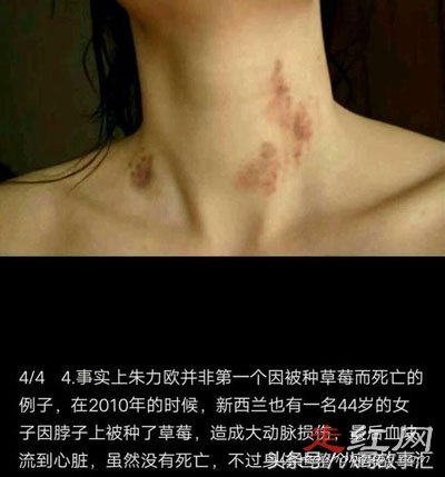 �����ֲ�ݮ��Σ����ȫ�� ����������岻����