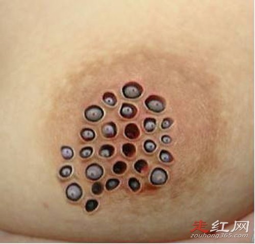 ��������ʲôԭ����ɵ� �ܼ��־�֢ͼƬ�ö���