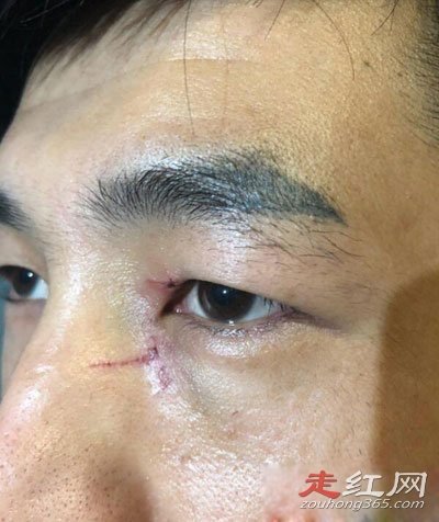 ����������ĳ��¼�ȫ���� �����Ƶ����Ϊʲô