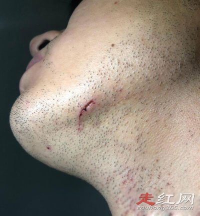 ����������ĳ��¼�ȫ���� �����Ƶ����Ϊʲô