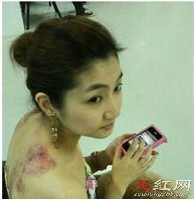 �μ���Ϊʲô��Ļ� ʲôʱ���������ڻָ�����Ƭ