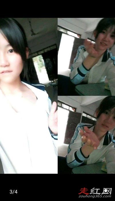 ���簩֢�����Ǽ� ����Ů����������Ƭ