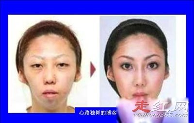 �뽡��鰸�����Ǽ� ��״���Լ����ӳ�