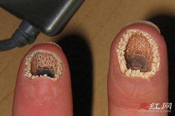 莲蓬乳空手指牙膏脸是什么东西就是经典的密集物体